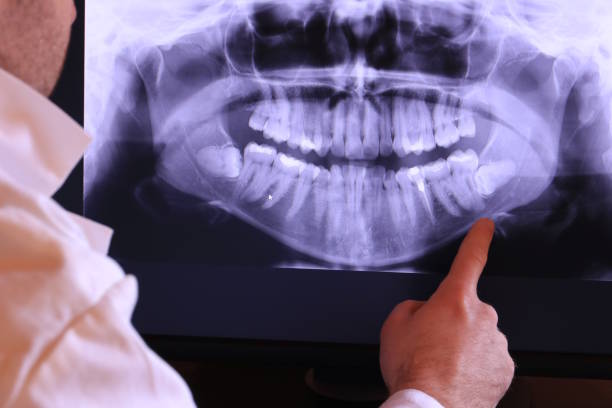 Best Chipped Tooth Repair Near Me  in Paoli, IN