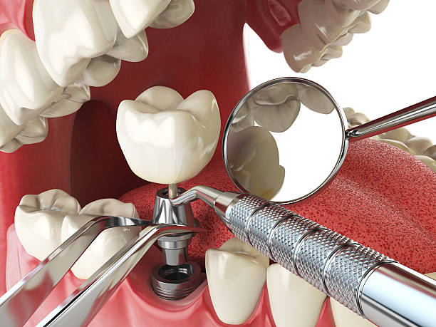 Best Broken Tooth Emergency  in Paoli, IN